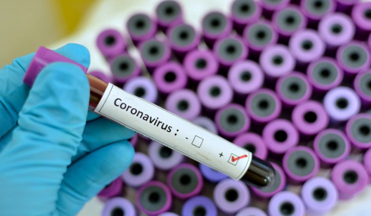 Qui a crée le Coronavirus ?